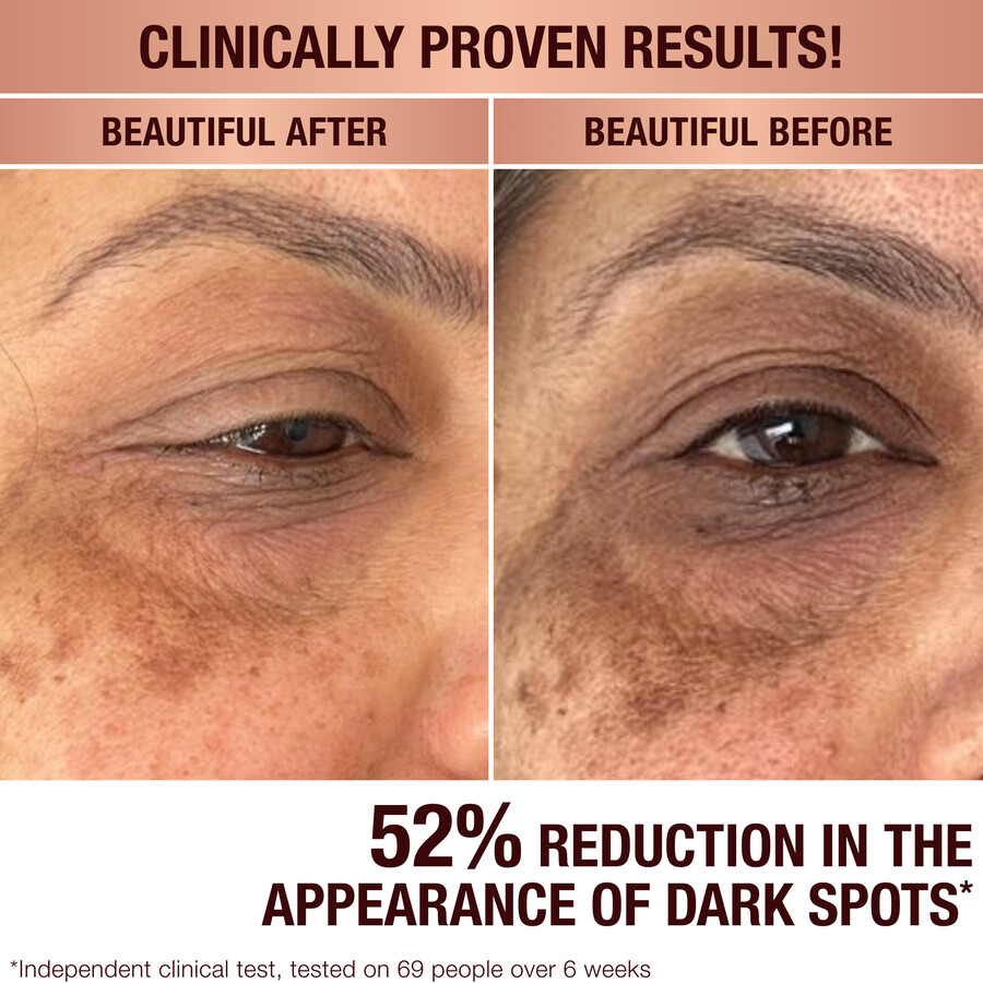 dark spot correcting radiance recovery serum