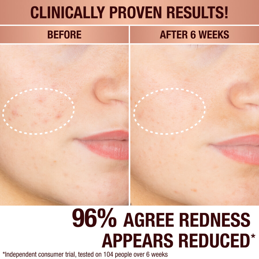 dark spot correcting protect hydrate glow kit